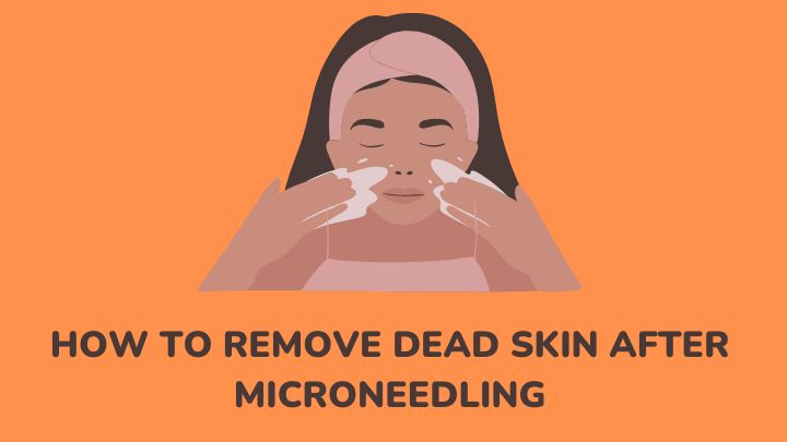 how to remove dead skin after microneedling