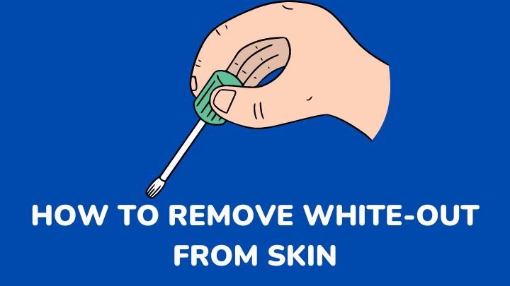 how to remove white-out from skin